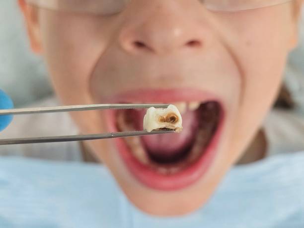 Best Emergency Orthodontic Repairs in Crainvle, IL